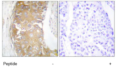 Immunohistochemistry (Formalin/PFA-fixed paraffin-embedded sections) - Anti-FRK antibody (AB64914)