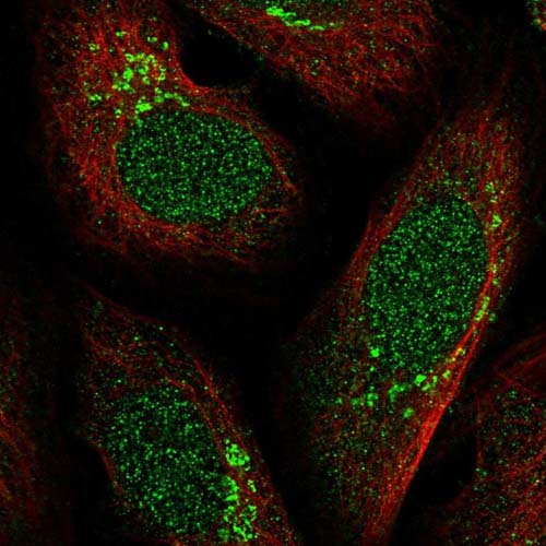 Immunocytochemistry/ Immunofluorescence - Anti-FRMD4A antibody (AB122475), expandable thumbnail