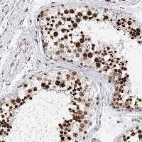 Immunohistochemistry (Formalin/PFA-fixed paraffin-embedded sections) - Anti-FRMD4A antibody (AB122475), expandable thumbnail