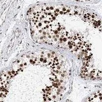 Immunohistochemistry (Formalin/PFA-fixed paraffin-embedded sections) - Anti-FRMD4A antibody (AB122475)