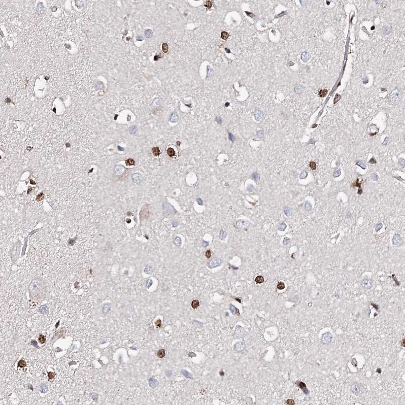 Immunohistochemistry (Formalin/PFA-fixed paraffin-embedded sections) - Anti-FRMD4A antibody (AB122475), expandable thumbnail
