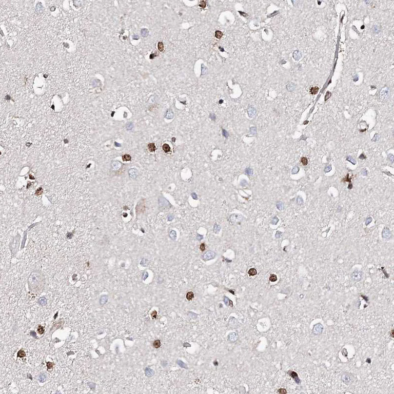 Immunohistochemistry (Formalin/PFA-fixed paraffin-embedded sections) - Anti-FRMD4A antibody (AB122475)