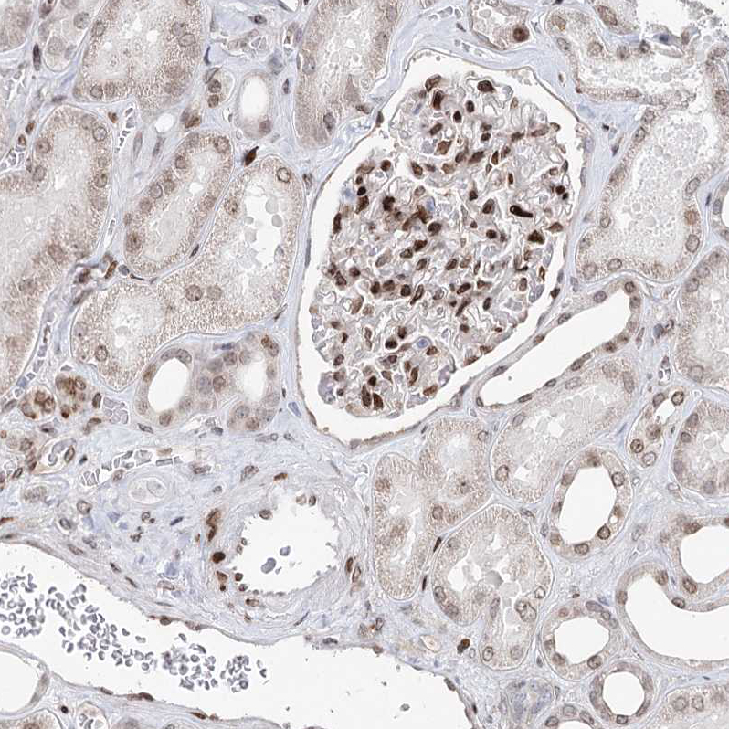 Immunohistochemistry (Formalin/PFA-fixed paraffin-embedded sections) - Anti-FRMD4A antibody (AB122475), expandable thumbnail