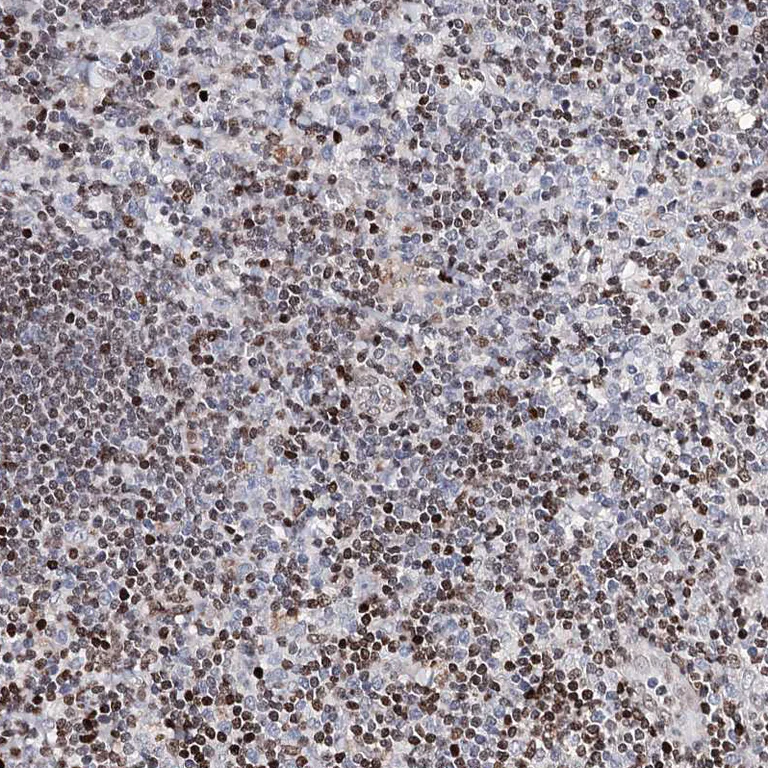 Immunohistochemistry (Formalin/PFA-fixed paraffin-embedded sections) - Anti-FRMD4A antibody (AB122475)