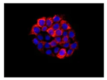 Immunocytochemistry/ Immunofluorescence - Anti-FRMD6/Willin antibody [EPR12261] - BSA and Azide free (AB249649)