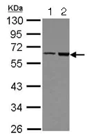 Western blot - Anti-FRMD8 antibody (AB127745)