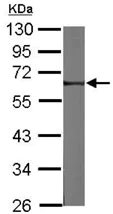 Western blot - Anti-FRMD8 antibody (AB127745)