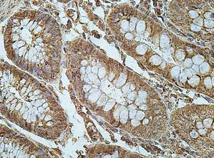 Immunohistochemistry (Formalin/PFA-fixed paraffin-embedded sections) - Anti-FRMD8 antibody (AB169933)