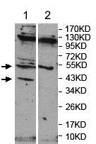 Western blot - Anti-FRMD8 antibody (AB169933)