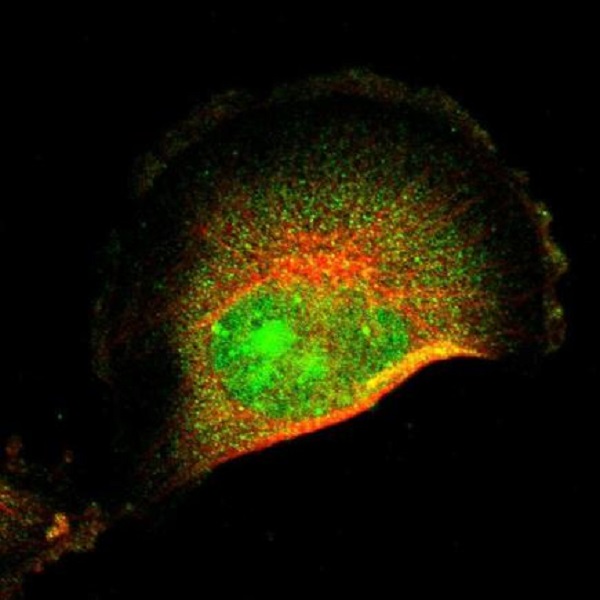 Immunocytochemistry/ Immunofluorescence - Anti-FRMD8 antibody (AB219857)