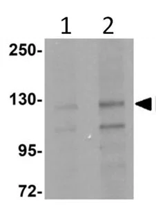 Western blot - Anti-FRMPD4 antibody (AB113420)