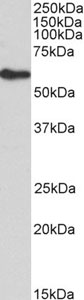 Western blot - Anti-FRS2 antibody (AB200548)