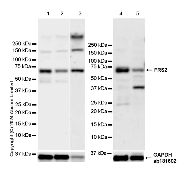 Western blot - Anti-FRS2 antibody [EPR28714-126] - BSA and Azide free (AB320728)