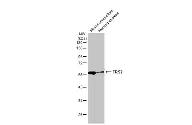 Western blot - Anti-FRS2 antibody [HL1774] - BSA and Azide free (AB308575)