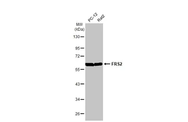 Western blot - Anti-FRS2 antibody [HL1774] - BSA and Azide free (AB308575)
