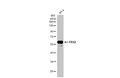 Western blot - Anti-FRS2 antibody [HL1774] - BSA and Azide free (AB308575)