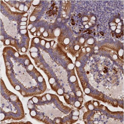 Immunohistochemistry (Formalin/PFA-fixed paraffin-embedded sections) - Anti-FRY antibody (AB150876)