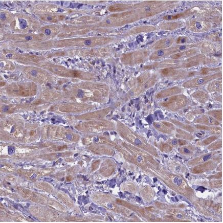 Immunohistochemistry (Formalin/PFA-fixed paraffin-embedded sections) - Anti-FRY antibody (AB150876)