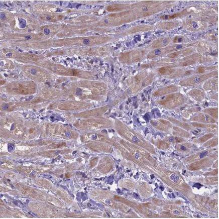 Immunohistochemistry (Formalin/PFA-fixed paraffin-embedded sections) - Anti-FRY antibody (AB150876)