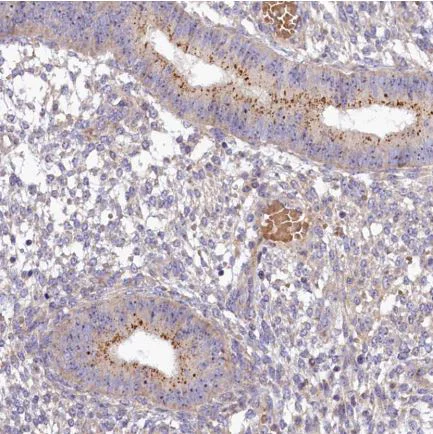 Immunohistochemistry (Formalin/PFA-fixed paraffin-embedded sections) - Anti-FRY antibody (AB150876)