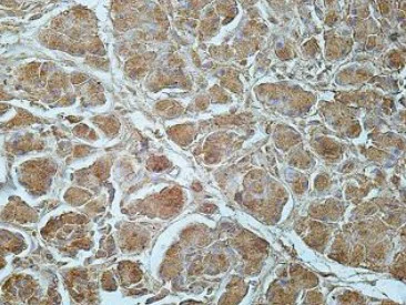 Immunohistochemistry (Formalin/PFA-fixed paraffin-embedded sections) - Anti-FRZB antibody (AB205284)