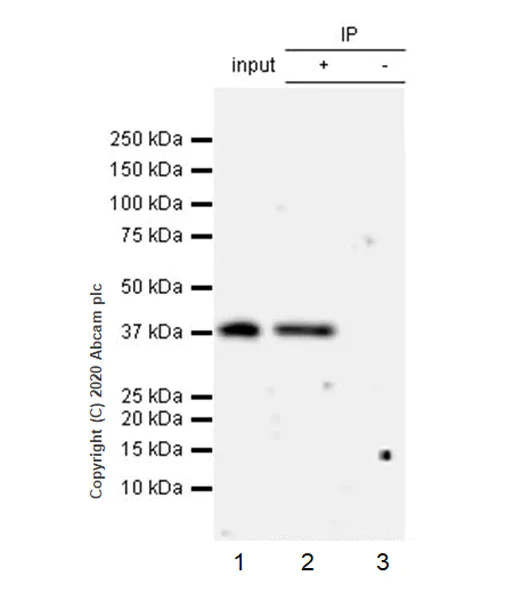Immunoprecipitation - Anti-FRZB antibody [EPR23904-20] (AB273582)