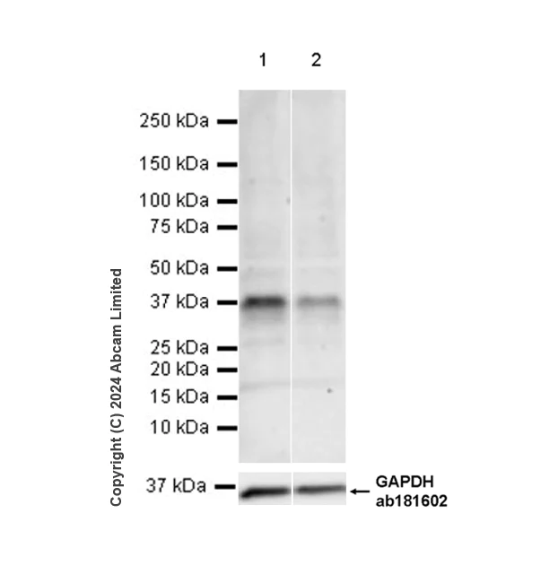 Western blot - Anti-FRZB antibody [EPR29379-32] - BSA and Azide free (AB324820)