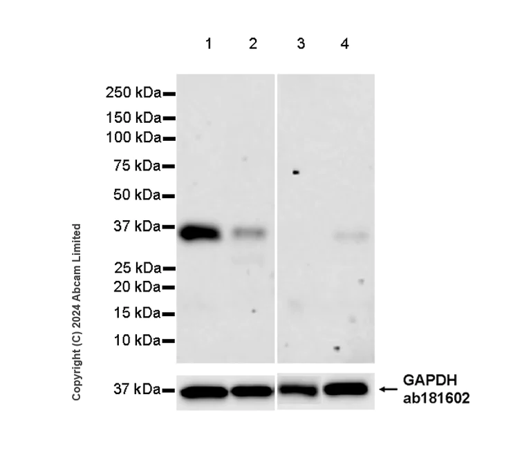 Western blot - Anti-FRZB antibody [EPR29379-32] - BSA and Azide free (AB324820)