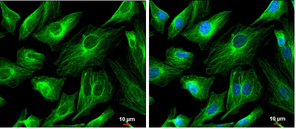 Immunocytochemistry/ Immunofluorescence - Anti-FSD1 antibody (AB229666)