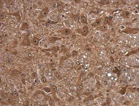 Immunohistochemistry (Formalin/PFA-fixed paraffin-embedded sections) - Anti-FSD1 antibody (AB229666)