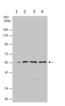 Western blot - Anti-FSD1 antibody (AB229666)