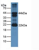 Western blot - Anti-FSH beta antibody (AB231672)