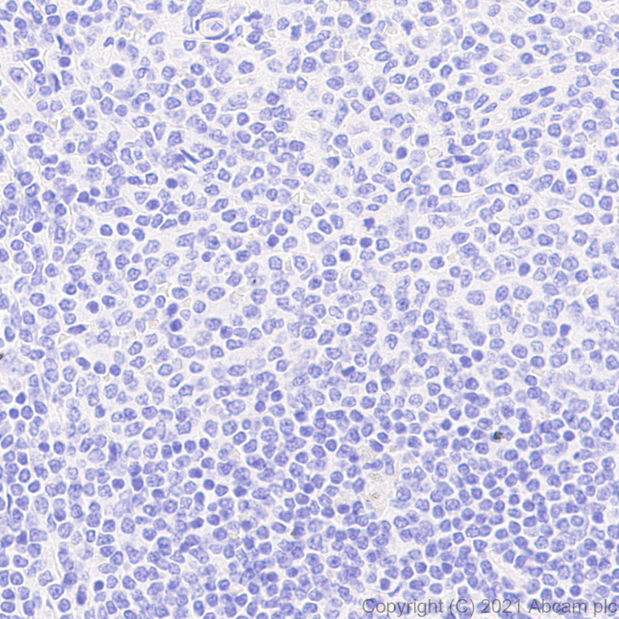 Immunohistochemistry (Formalin/PFA-fixed paraffin-embedded sections) - Anti-FSH beta antibody [EPR24439-141] (AB281562)