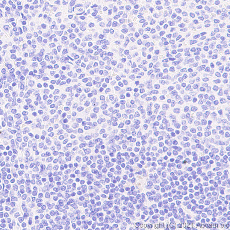 Immunohistochemistry (Formalin/PFA-fixed paraffin-embedded sections) - Anti-FSH beta antibody [EPR24439-141] (AB281562)