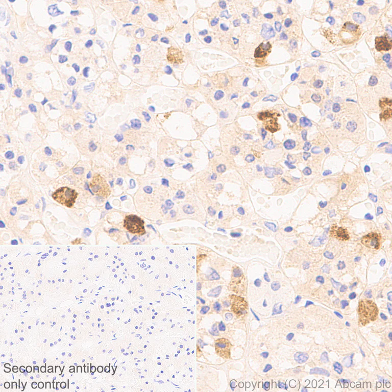 Immunohistochemistry (Formalin/PFA-fixed paraffin-embedded sections) - Anti-FSH beta antibody [EPR24439-141] (AB281562)