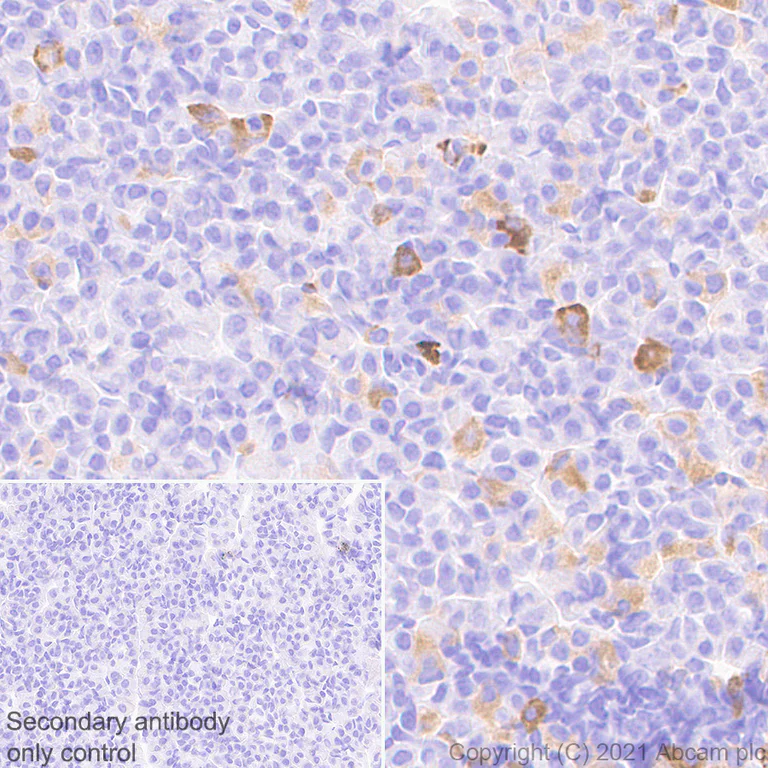 Immunohistochemistry (Formalin/PFA-fixed paraffin-embedded sections) - Anti-FSH beta antibody [EPR24439-141] (AB281562)