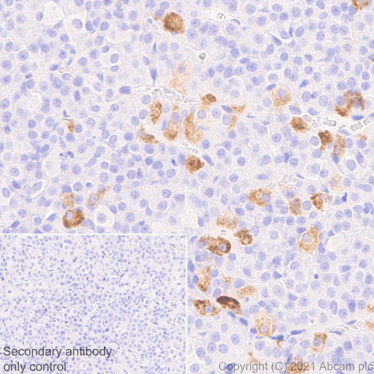 Immunohistochemistry (Formalin/PFA-fixed paraffin-embedded sections) - Anti-FSH beta antibody [EPR24439-141] (AB281562)