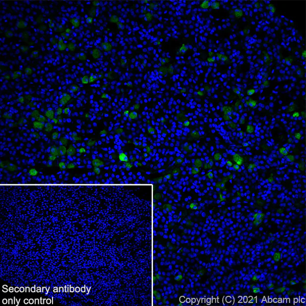 Immunohistochemistry (Frozen sections) - Anti-FSH beta antibody [EPR24439-141] (AB281562)