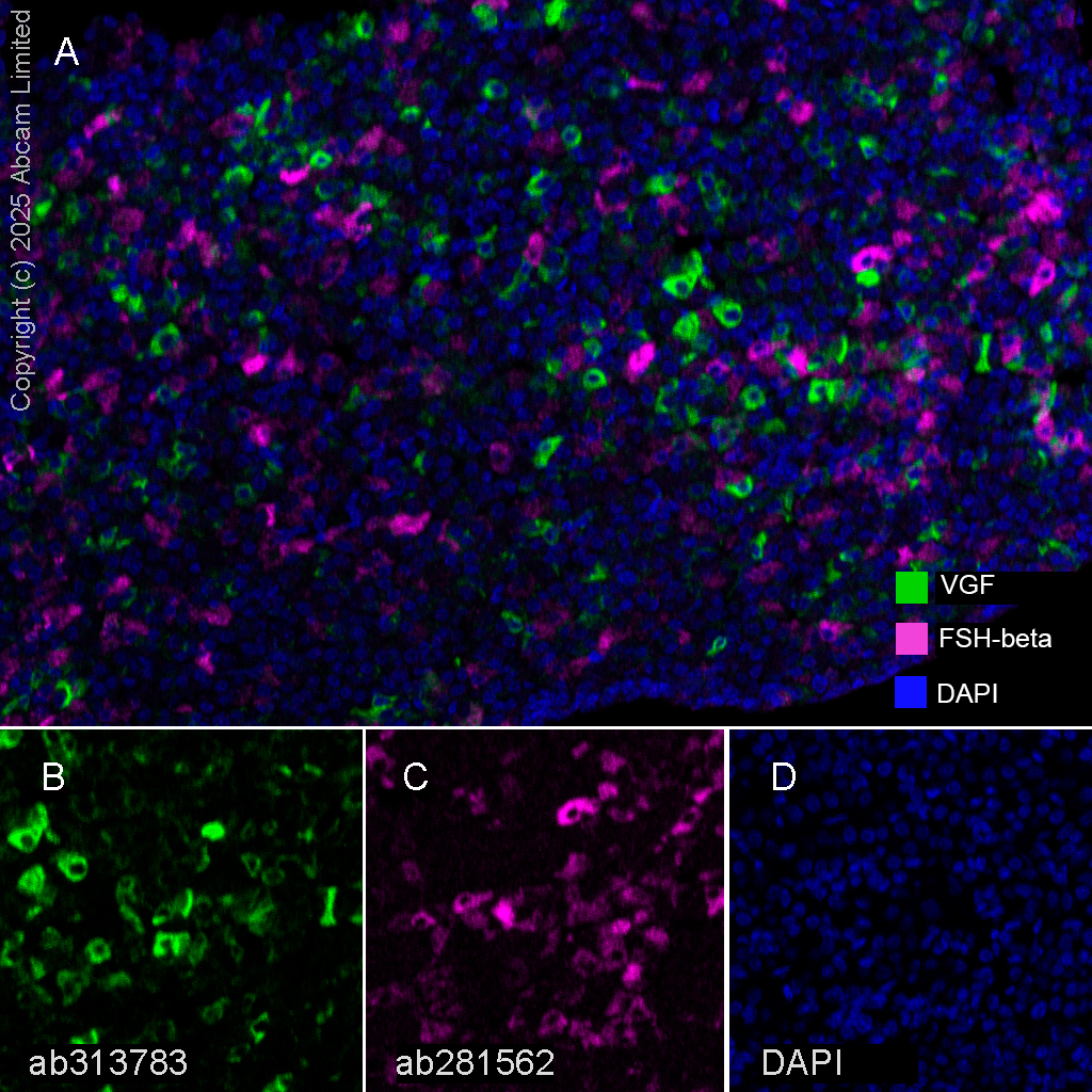 Multiplex immunohistochemistry - Anti-FSH beta antibody [EPR24439-141] (AB281562)