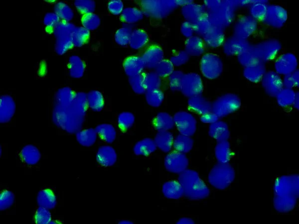 Immunocytochemistry/ Immunofluorescence - Anti-FSH beta antibody [EPR7931] - BSA and Azide free (AB250192)