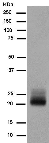 Western blot - Anti-FSH beta antibody [EPR7931] - BSA and Azide free (AB250192), expandable thumbnail