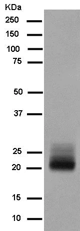 Western blot - Anti-FSH beta antibody [EPR7931] - BSA and Azide free (AB250192)