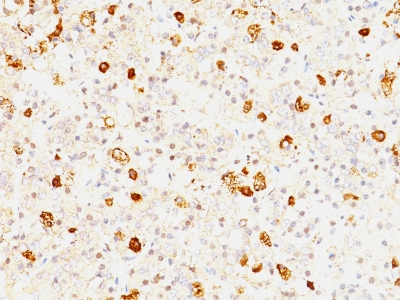Immunohistochemistry (Formalin/PFA-fixed paraffin-embedded sections) - Anti-FSH beta antibody [FSHb/1062] (AB233866), expandable thumbnail