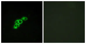 Immunocytochemistry/ Immunofluorescence - Anti-FSH-R antibody (AB113421)