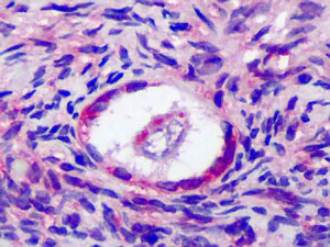 Immunohistochemistry (Formalin/PFA-fixed paraffin-embedded sections) - Anti-FSH-R antibody (AB113421)