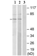 Western blot - Anti-FSH-R antibody (AB75200)