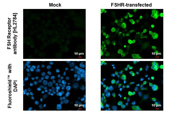 Immunocytochemistry/ Immunofluorescence - Anti-FSHR antibody [HL2784] - BSA and Azide free (AB325857)