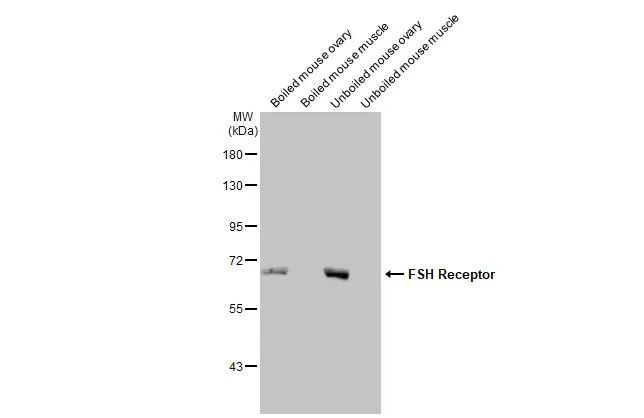 Western blot - Anti-FSHR antibody [HL2784] - BSA and Azide free (AB325857)
