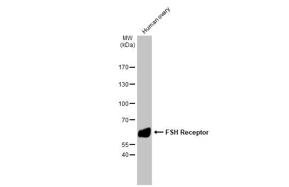 Western blot - Anti-FSHR antibody [HL2784] - BSA and Azide free (AB325857)