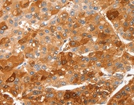Immunohistochemistry (Formalin/PFA-fixed paraffin-embedded sections) - Anti-FSP27 antibody (AB198204)